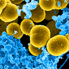 Исследование по применению эфирных масел при лечении Золотистого Стафилококка (Staphylococcus aureus)
